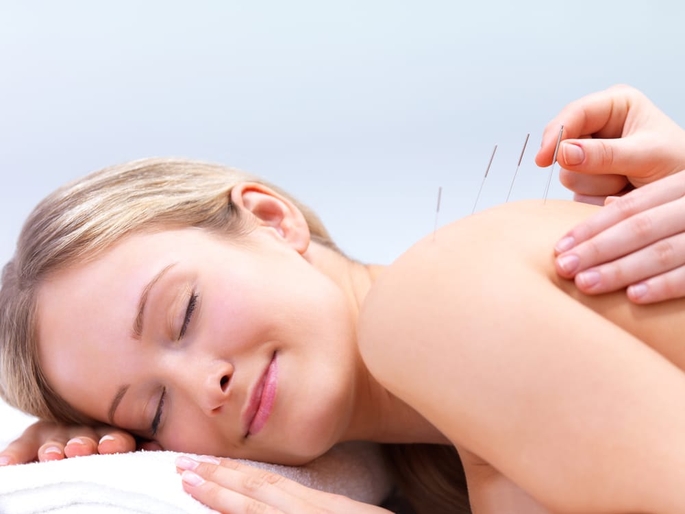 Acupuncture Coverage in Health Insurance